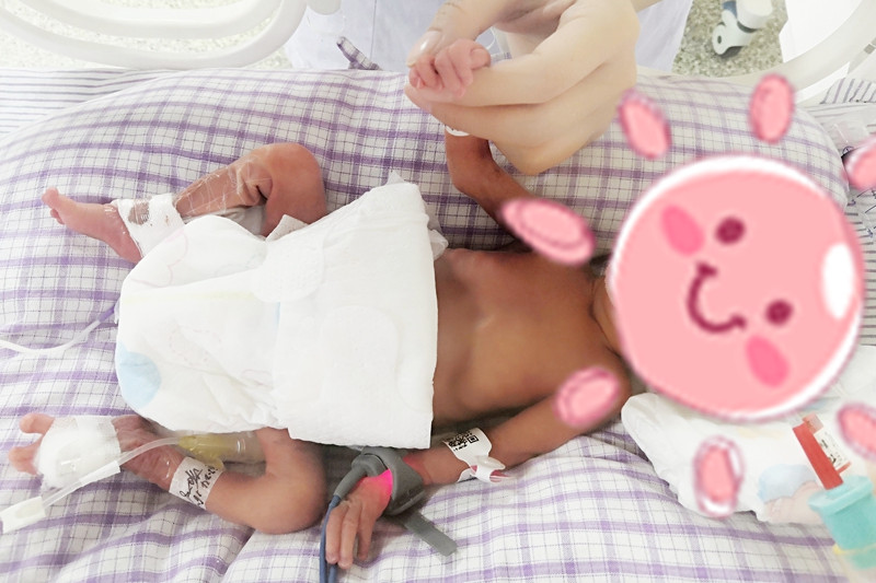 0607 新生兒科 早產(chǎn)兒6_副本.jpg